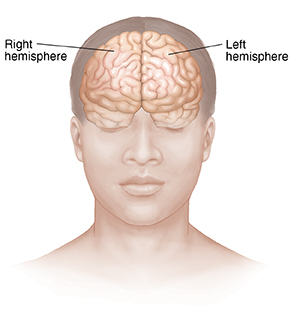 Front view of head and upper body showing brain.