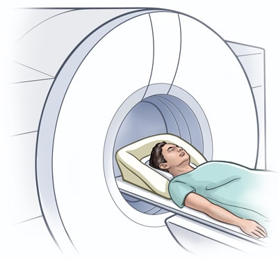 MRI Scan